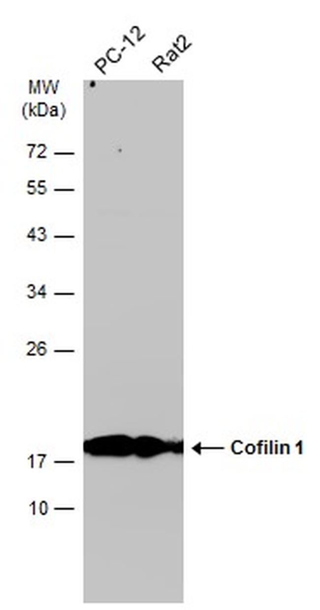 Cofilin Antibody in Western Blot (WB)