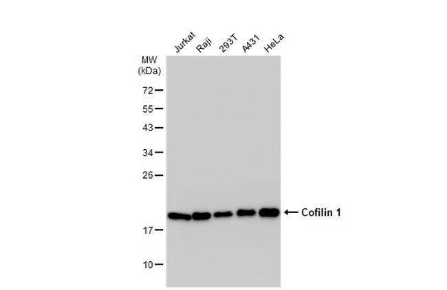 Cofilin Antibody in Western Blot (WB)