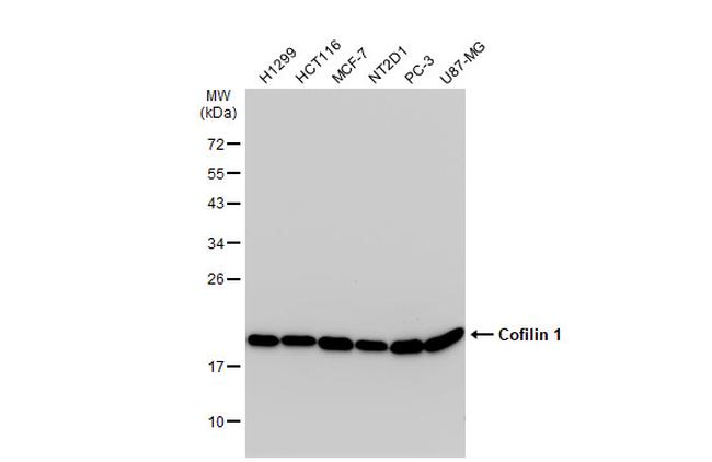 Cofilin Antibody in Western Blot (WB)