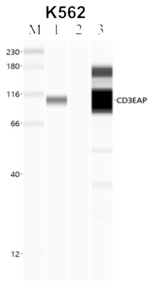 PAF49 Antibody in RNA Immunoprecipitation (RIP)