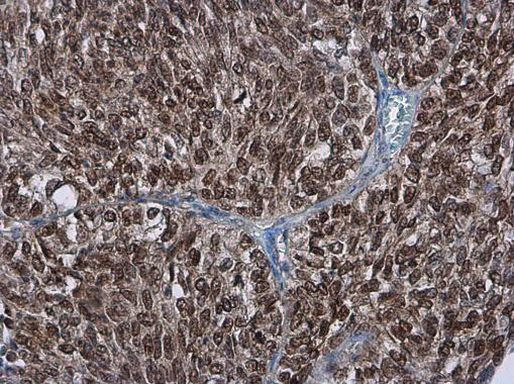 PAF49 Antibody in Immunohistochemistry (Paraffin) (IHC (P))