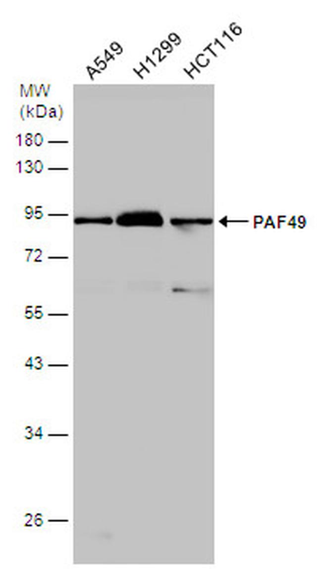 PAF49 Antibody in Western Blot (WB)