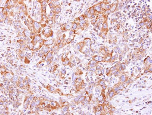 KARS Antibody in Immunohistochemistry (Paraffin) (IHC (P))