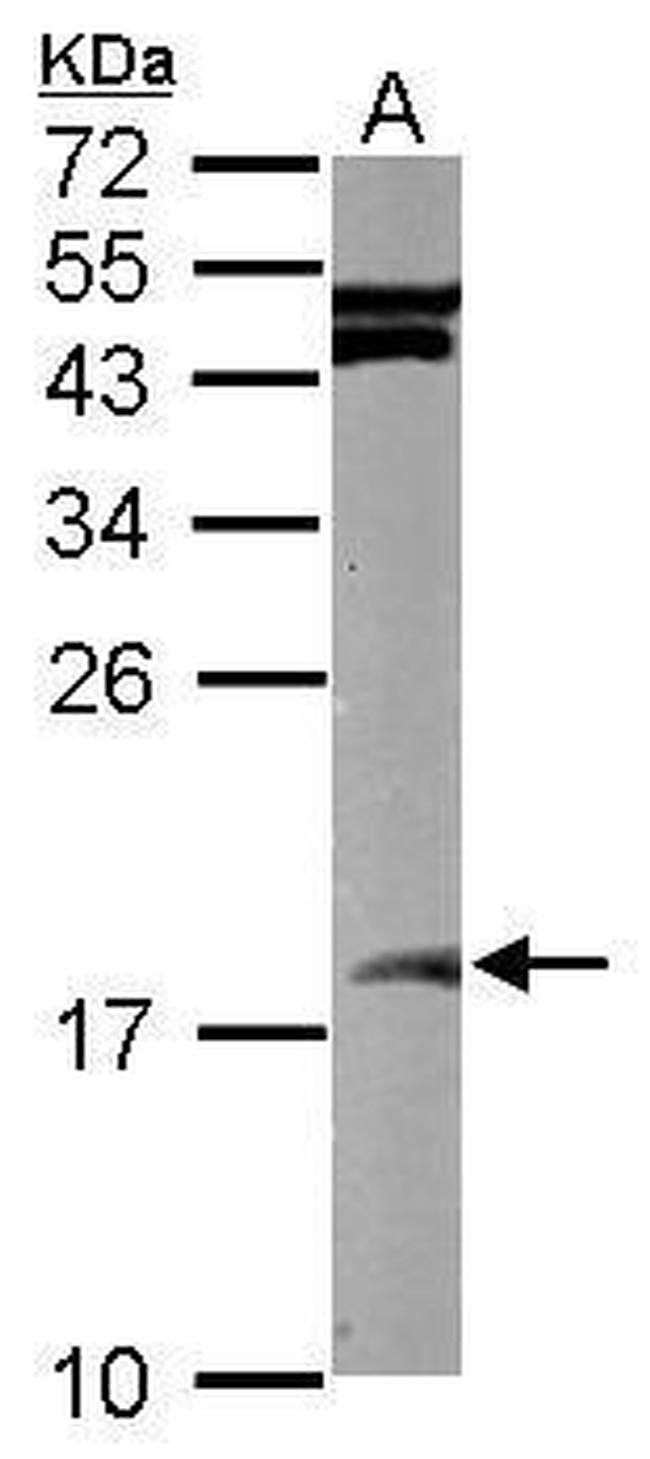 SUMO2 Antibody in Western Blot (WB)