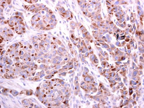 PDCD6 Antibody in Immunohistochemistry (Paraffin) (IHC (P))