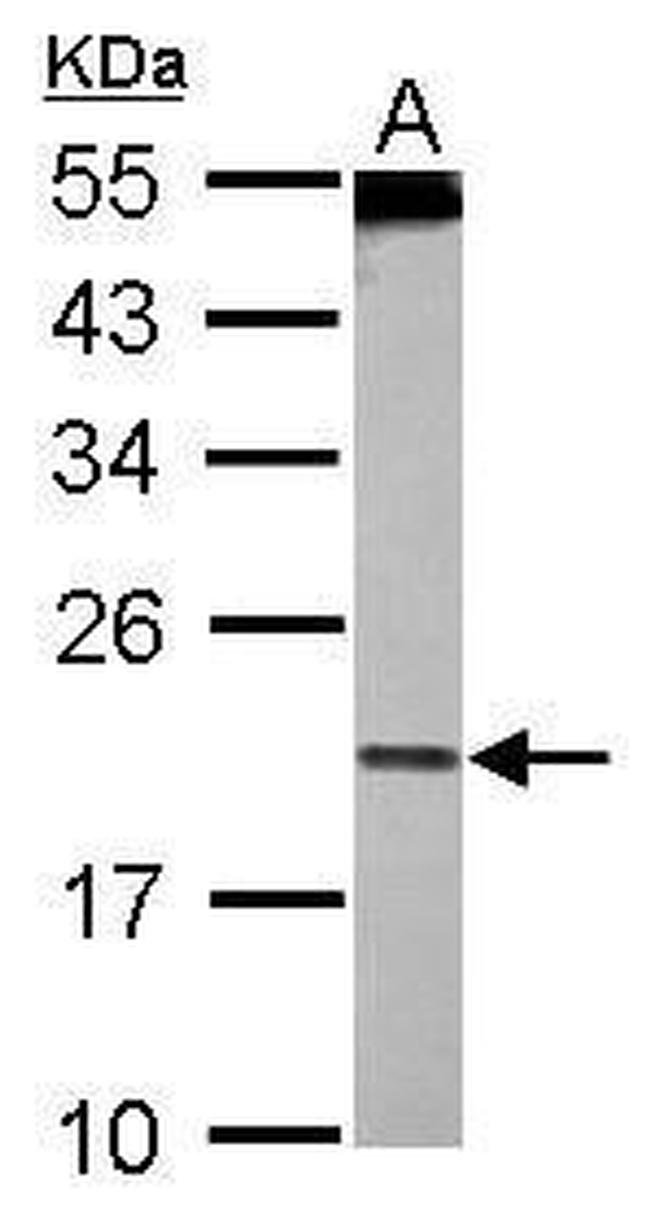 PDCD6 Antibody in Western Blot (WB)