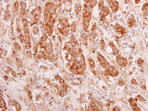 14-3-3 theta Antibody in Immunohistochemistry (Paraffin) (IHC (P))