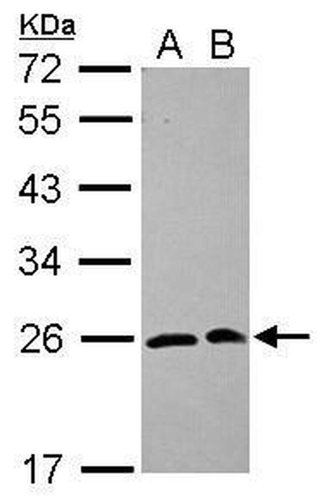 SAR1A Antibody in Western Blot (WB)