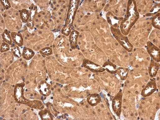 PPP2R1A Antibody in Immunohistochemistry (Paraffin) (IHC (P))