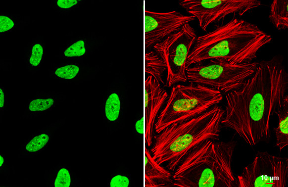 TRIM28 Antibody in Immunocytochemistry (ICC/IF)