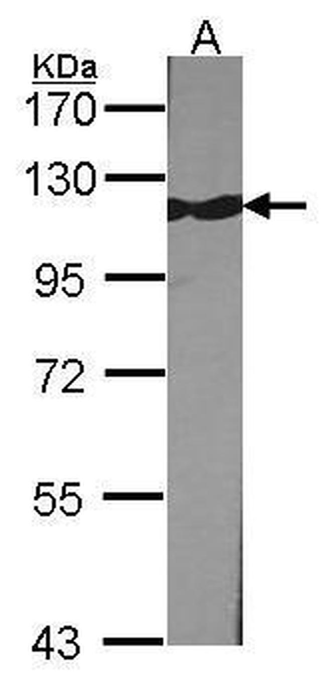 TRIM28 Antibody in Western Blot (WB)