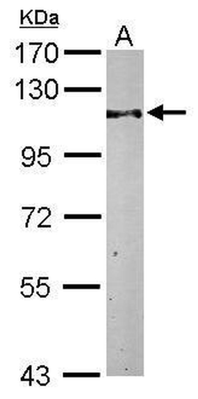 TRIM28 Antibody in Western Blot (WB)