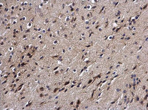 DPF2 Antibody in Immunohistochemistry (Paraffin) (IHC (P))