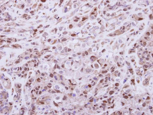 DPF2 Antibody in Immunohistochemistry (Paraffin) (IHC (P))