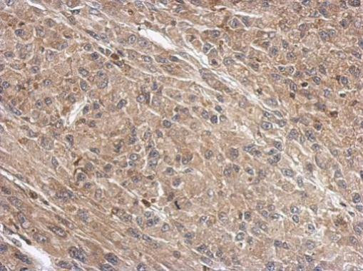 WDR1 Antibody in Immunohistochemistry (Paraffin) (IHC (P))