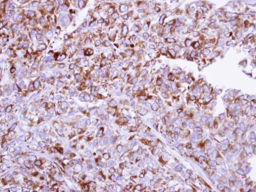 HYOU1 Antibody in Immunohistochemistry (Paraffin) (IHC (P))