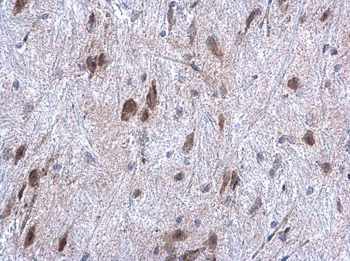 HYOU1 Antibody in Immunohistochemistry (Paraffin) (IHC (P))