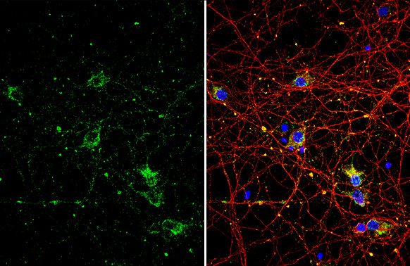 NGFR Antibody in Immunocytochemistry (ICC/IF)