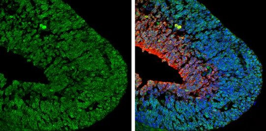 NGFR Antibody in Immunohistochemistry (Frozen) (IHC (F))