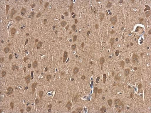 NGFR Antibody in Immunohistochemistry (Paraffin) (IHC (P))