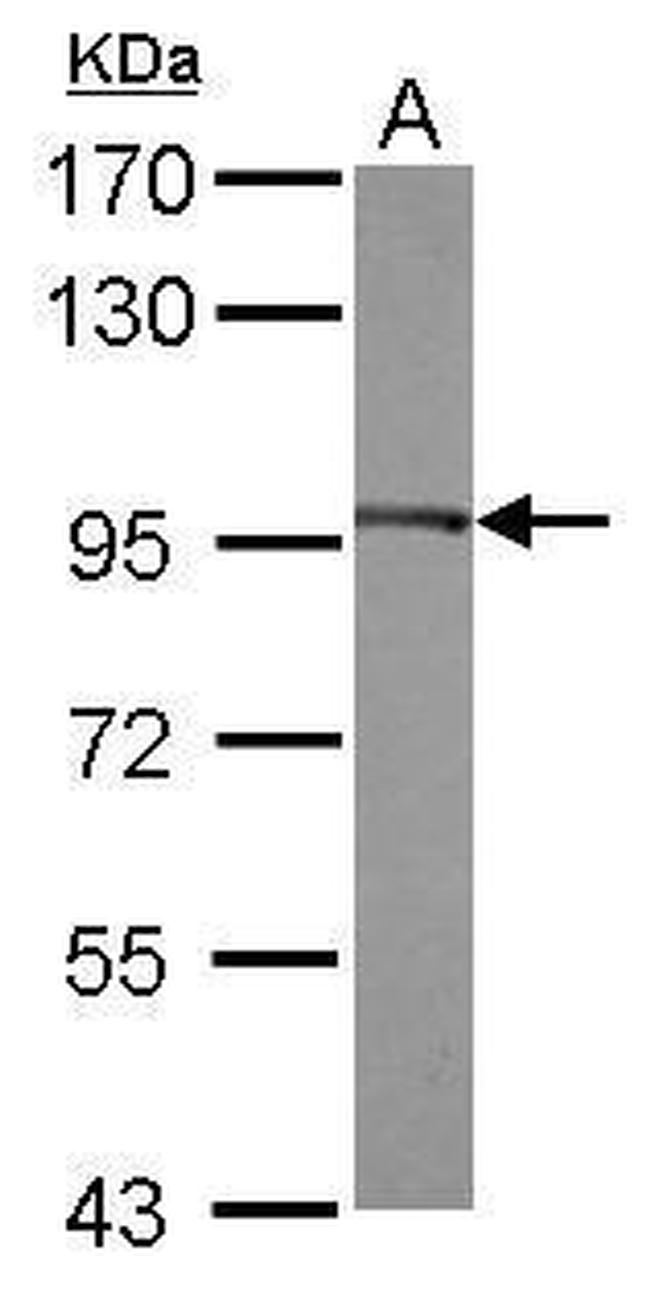 EEF2 Antibody in Western Blot (WB)