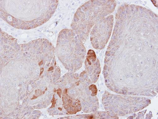 PSMD3 Antibody in Immunohistochemistry (Paraffin) (IHC (P))