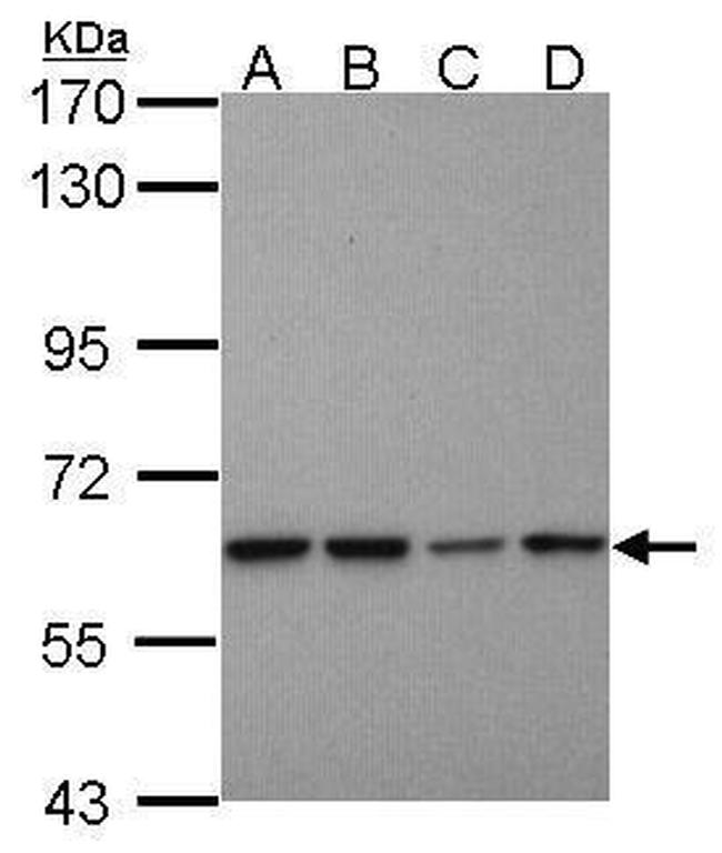 PSMD3 Antibody in Western Blot (WB)