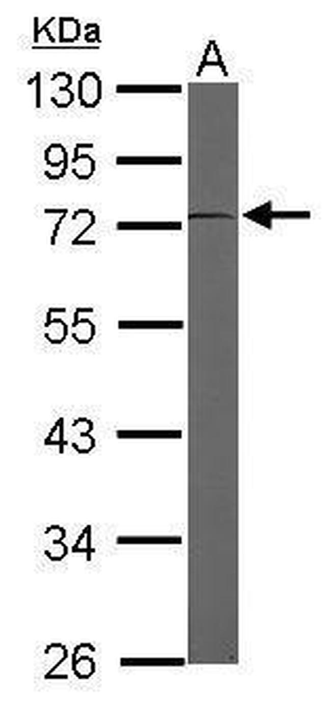 EEF1D Antibody in Western Blot (WB)