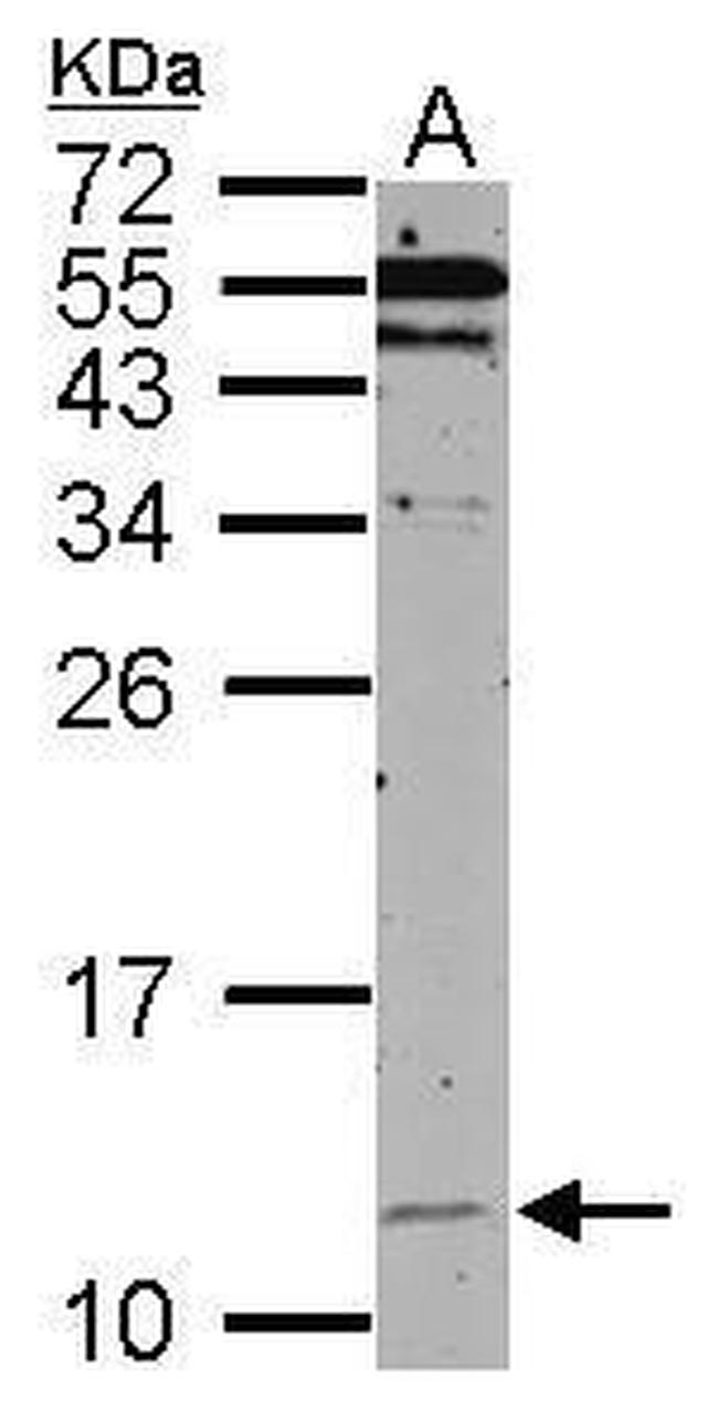 HSPE1 Antibody in Western Blot (WB)