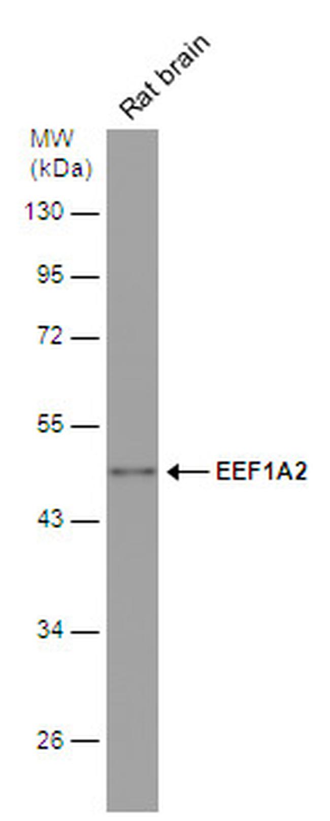 EEF1A2 Antibody in Western Blot (WB)