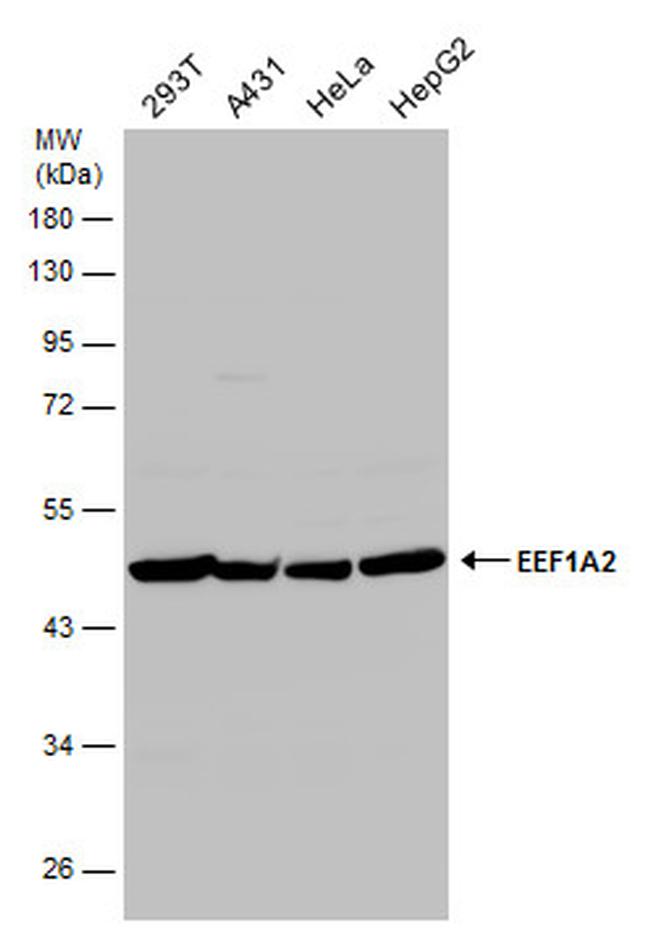 EEF1A2 Antibody in Western Blot (WB)