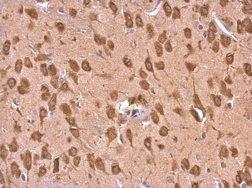 EEF1A2 Antibody in Immunohistochemistry (Paraffin) (IHC (P))