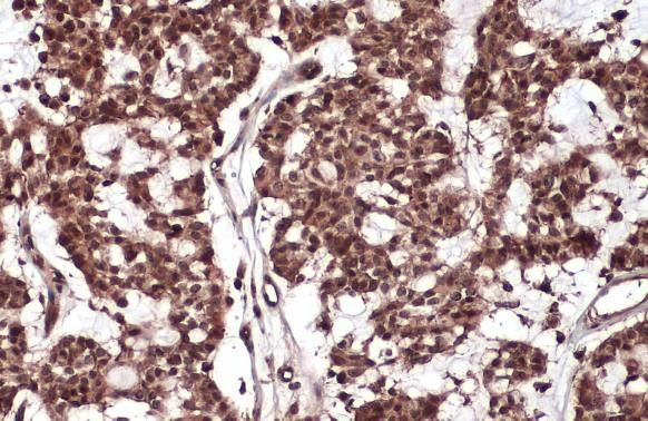 RelB Antibody in Immunohistochemistry (Paraffin) (IHC (P))