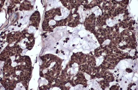 RelB Antibody in Immunohistochemistry (Paraffin) (IHC (P))