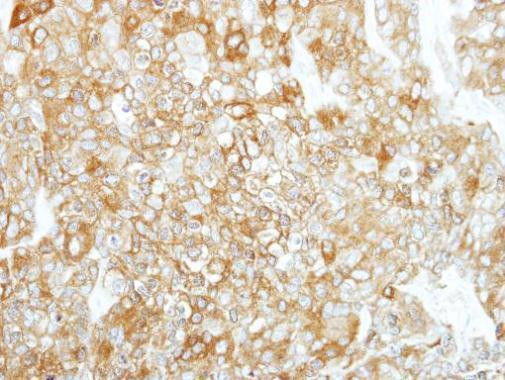 Mu-Calpain Antibody in Immunohistochemistry (Paraffin) (IHC (P))