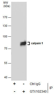 Mu-Calpain Antibody in Immunoprecipitation (IP)
