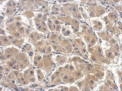 Caspase 6 Antibody in Immunohistochemistry (Paraffin) (IHC (P))