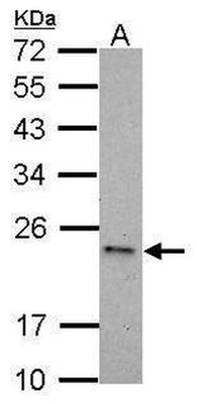 Caspase 6 Antibody in Western Blot (WB)