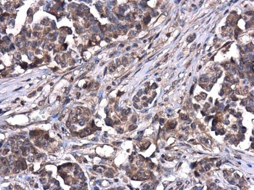 ATG5 Antibody in Immunohistochemistry (Paraffin) (IHC (P))