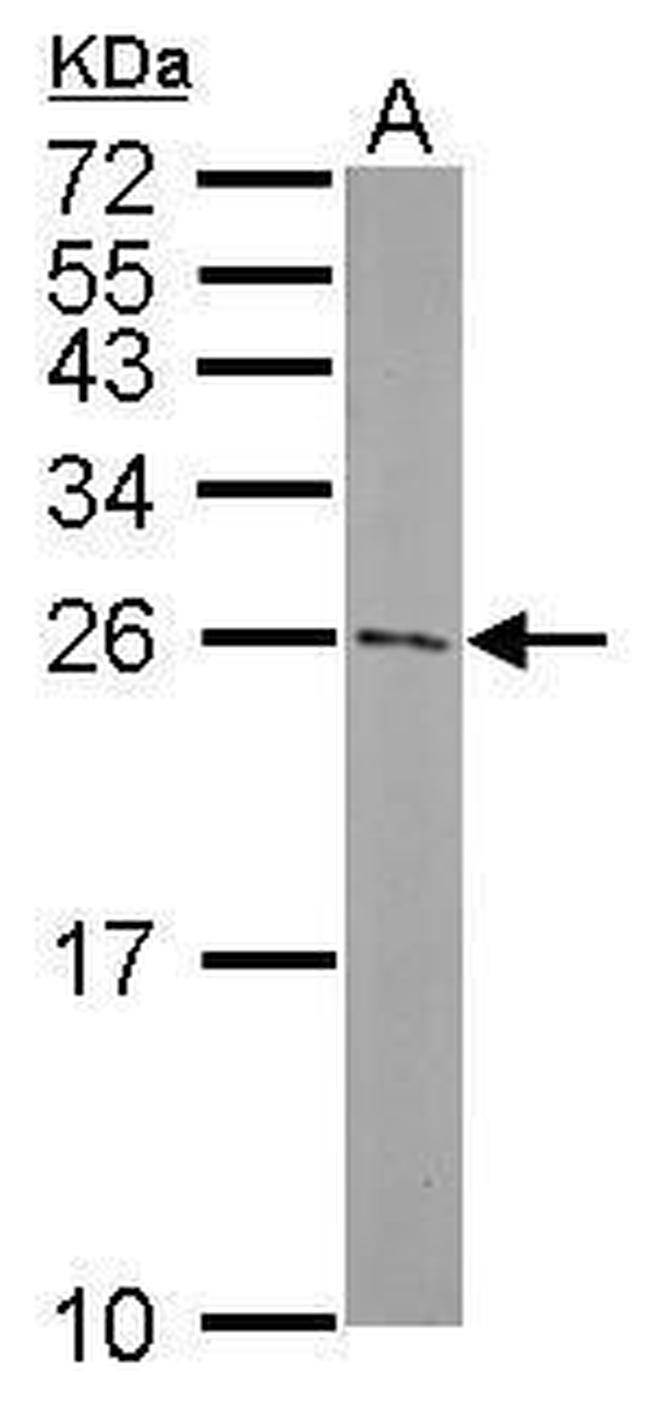 ATG5 Antibody in Western Blot (WB)