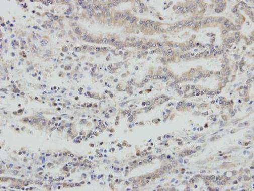 AIF Antibody in Immunohistochemistry (Paraffin) (IHC (P))