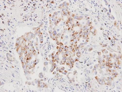 AIF Antibody in Immunohistochemistry (Paraffin) (IHC (P))