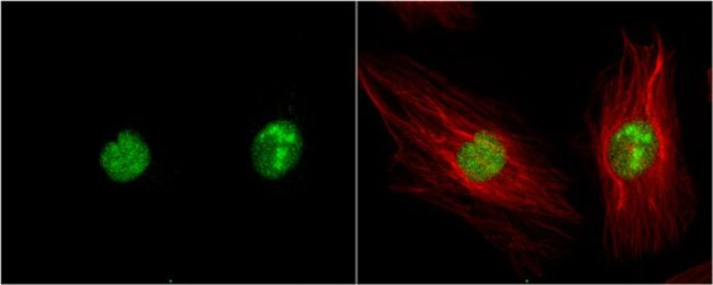 ZIPK Antibody in Immunocytochemistry (ICC/IF)