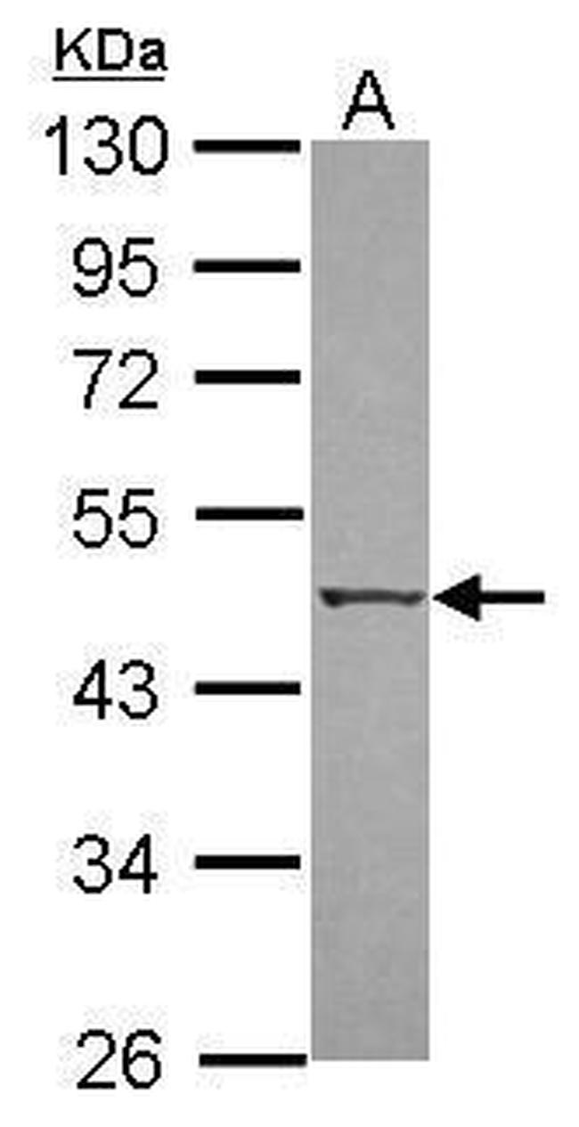 ZIPK Antibody in Western Blot (WB)