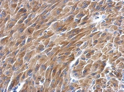 BAG2 Antibody in Immunohistochemistry (Paraffin) (IHC (P))