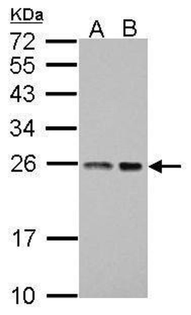 BAG2 Antibody in Western Blot (WB)