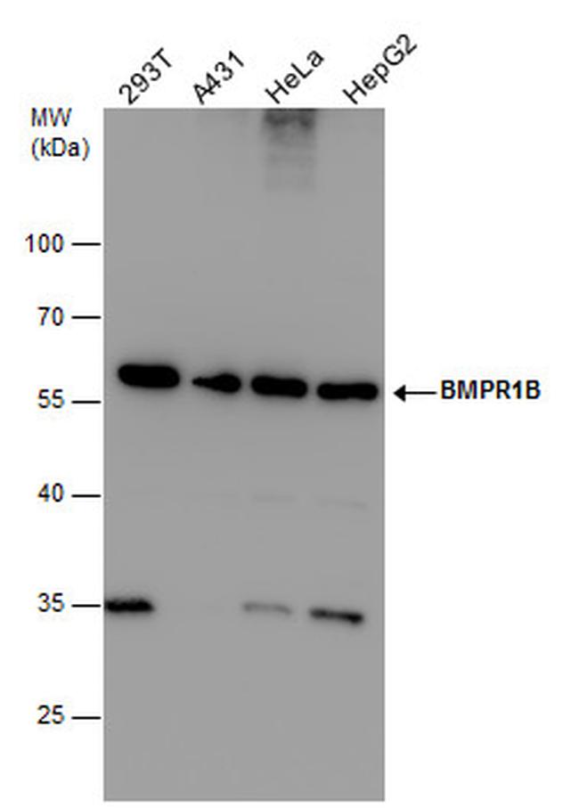 CDw293 Antibody in Western Blot (WB)