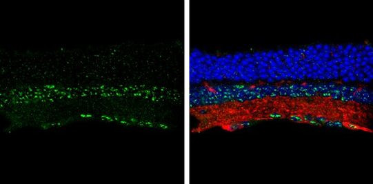 CDw293 Antibody in Immunohistochemistry (Frozen) (IHC (F))