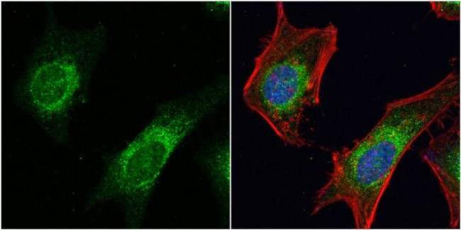 DVL3 Antibody in Immunocytochemistry (ICC/IF)