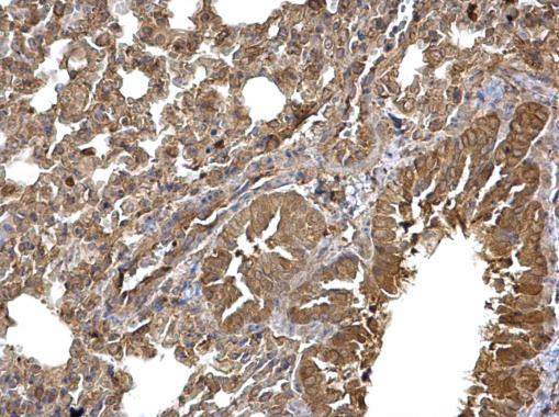 DVL3 Antibody in Immunohistochemistry (Paraffin) (IHC (P))